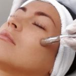 spa microdermabrasion